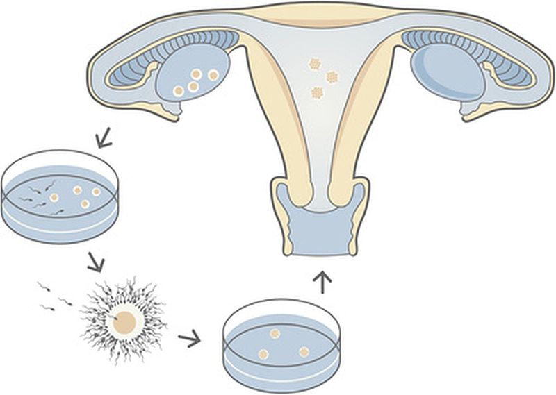 A diagram of the female reproductive system and the fertilization of an egg and sperm.