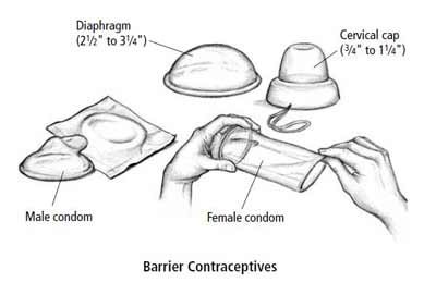 Diagram of cervical cap, female condom, male condom, and diaphragm