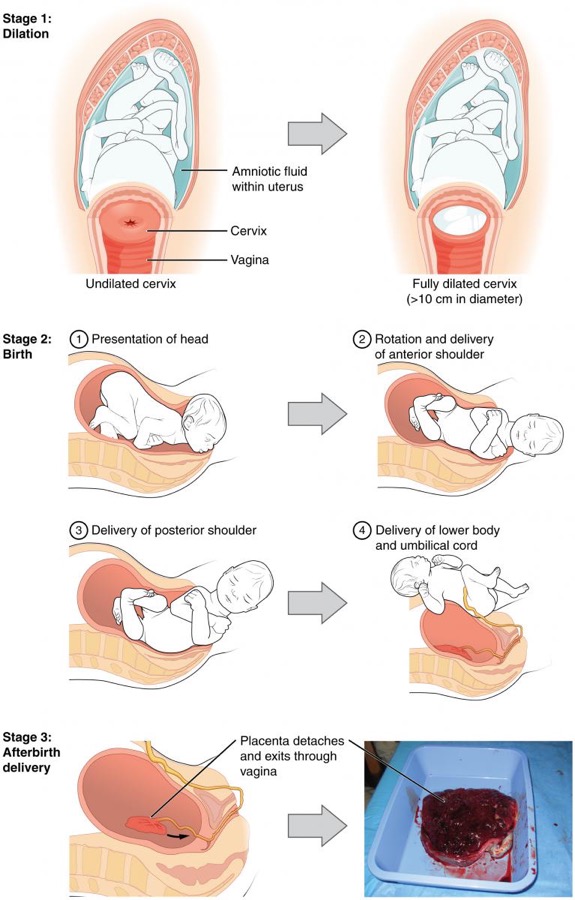 Childbirth diagram