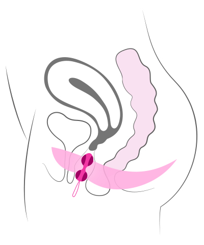 Diagram of ben wa balls inserted into a vagina.