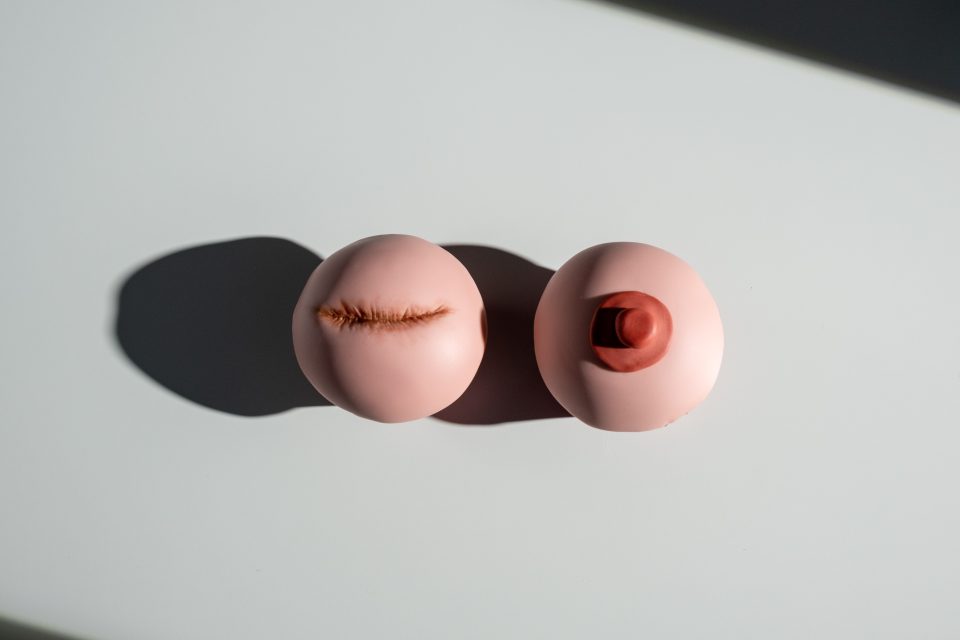 Two cupcakes that are shaped like breasts. One has a mastectomy scar.
