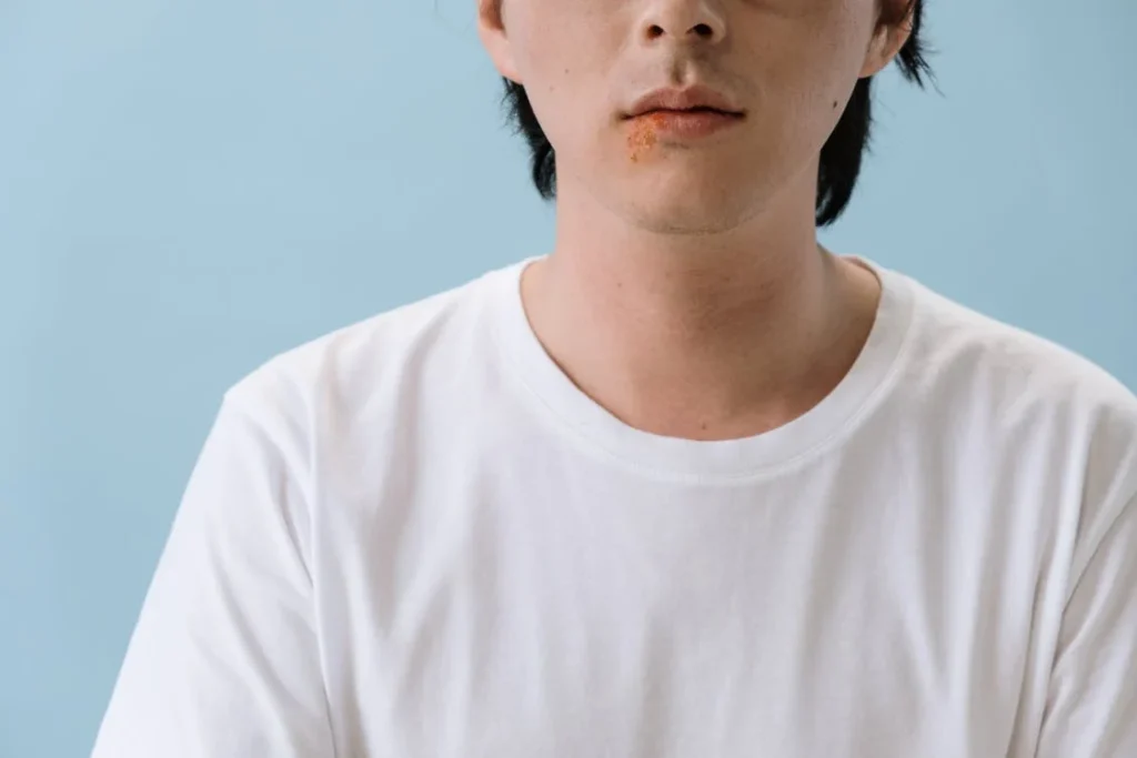 a person in a white t-shirt looks into the camera, on their lower lip they appear to have a red and pink rash.
