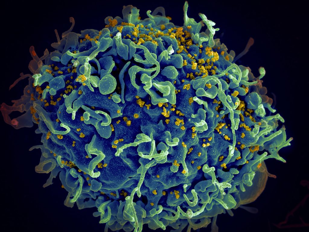 Yellow HIV virus infecting a human cell